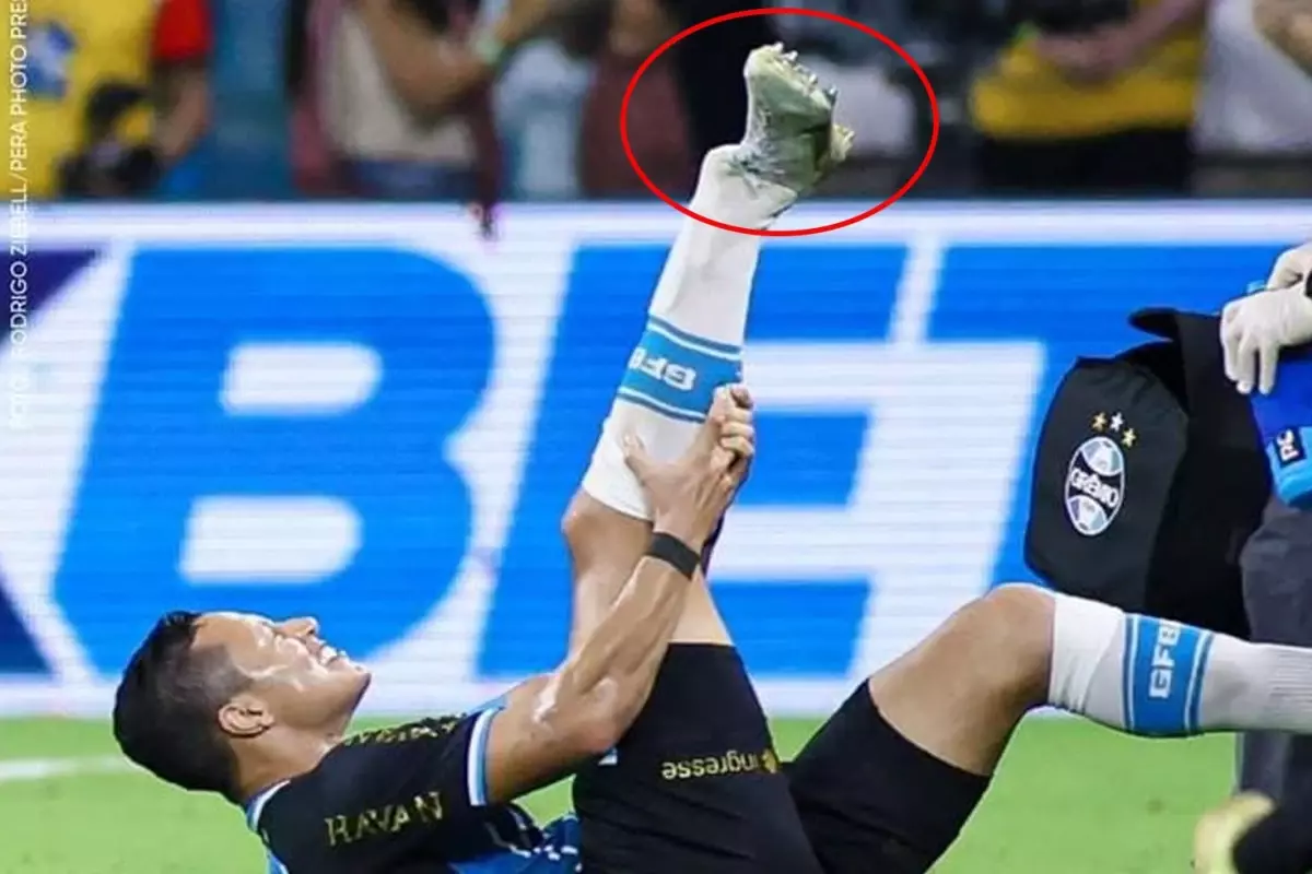 Eski Trabzonsporlu Marlon Sahada Dehşeti Yaşadı Ayak Bileği Kırıldı