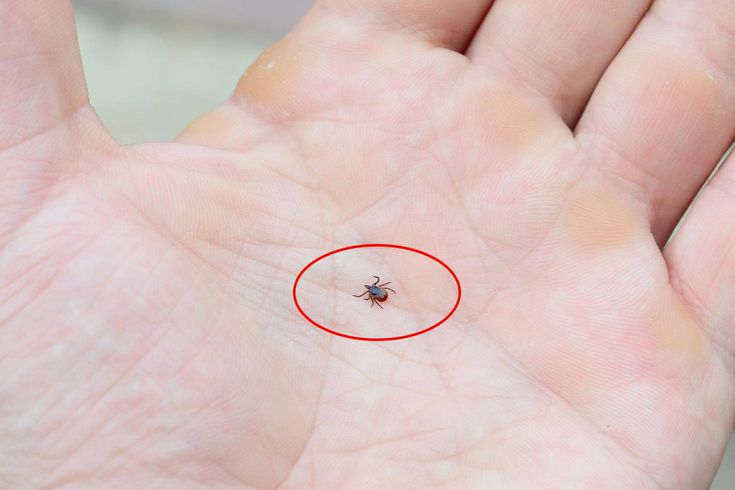 Kene Vakalarında Artış Uzmanlardan KKKA Uyarısı
