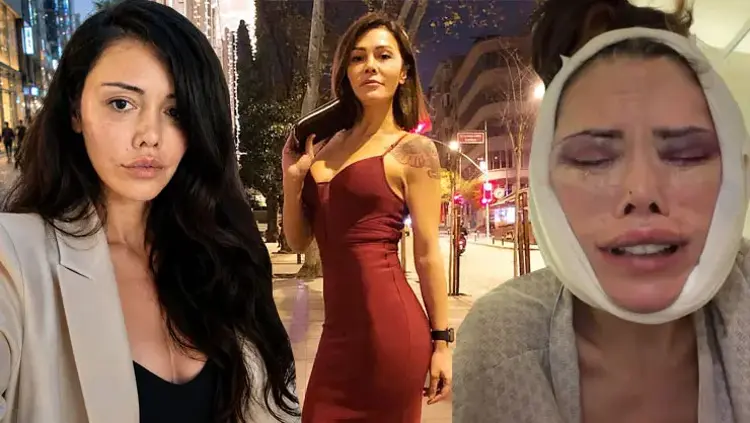 Didem Ceran Yeniden Ameliyat Oldu! Sosyal Medyada Gözyaşlarıyla Açıklama Yaptı